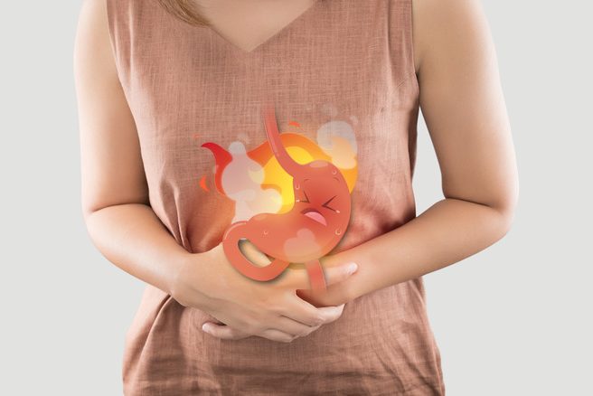 Acid Reflux